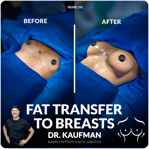 autologous fat graft to breasts, fat transfer to breasts, breast augmentation with fat, dr.kaufman, miami life plastic surgery,