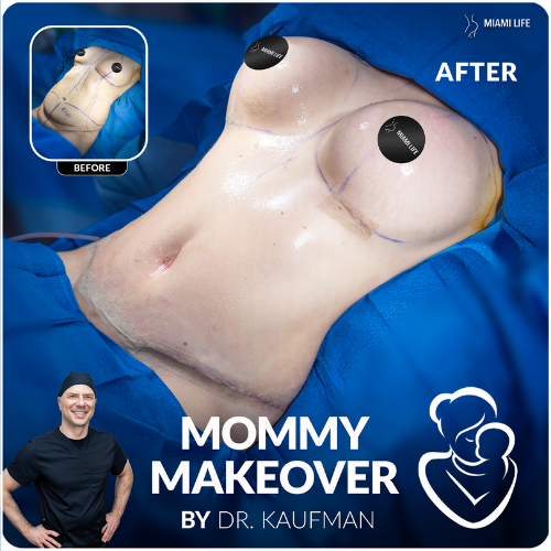 mommy-makeover-doctor-kaufman-miami-life-plastic-surgery